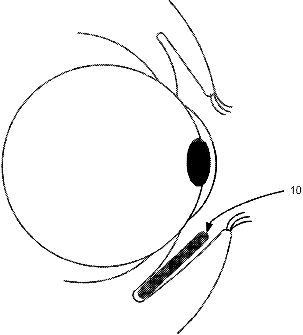 Patent drawing
